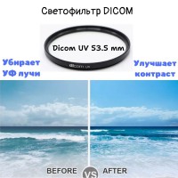 Dicom 53,5 mm UV фильтр